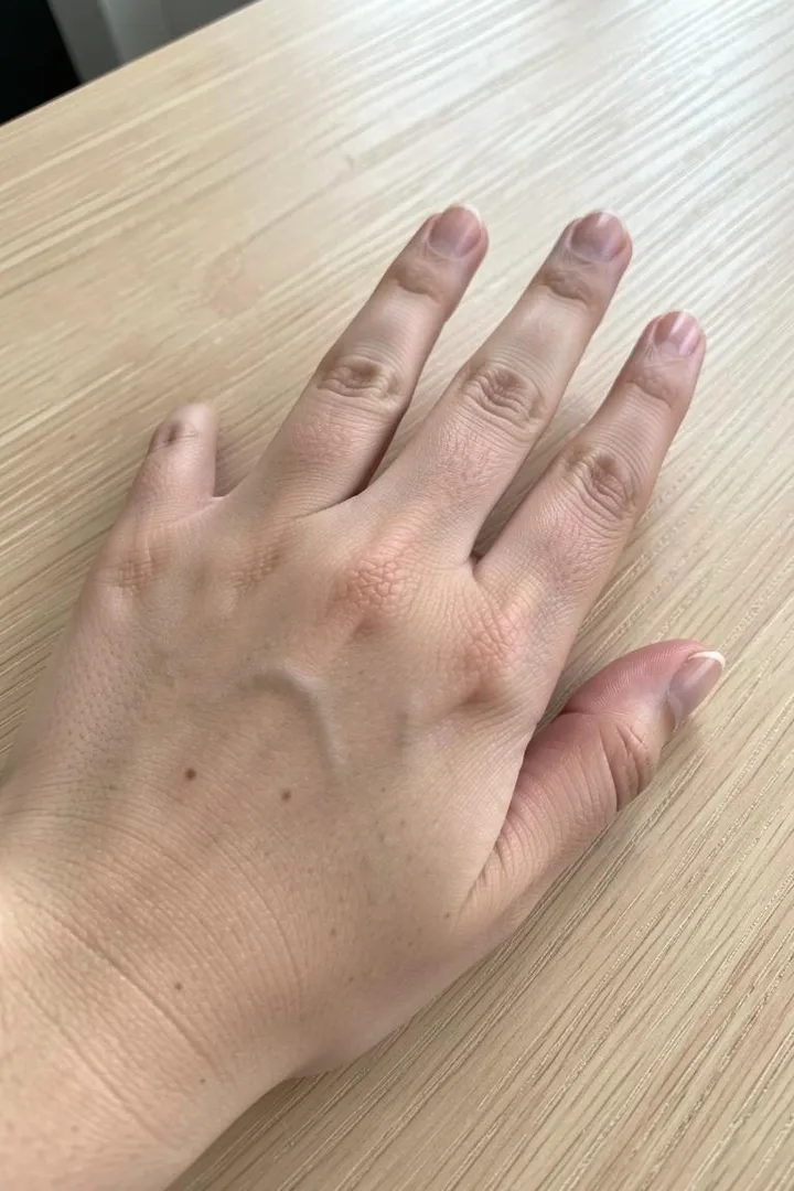 До — Примерка дизайна ногтей по фото руки